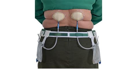 nephrostomy tube belt